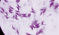Sabin-Feldman dye test